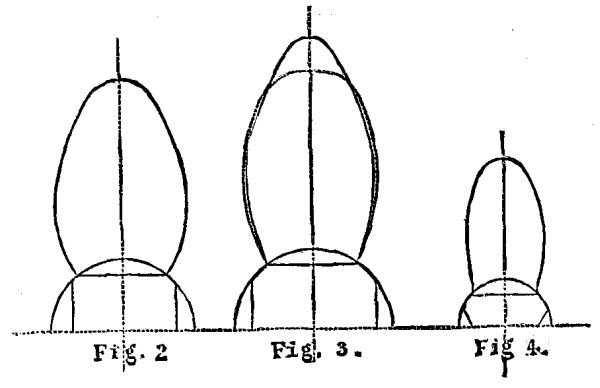  FIG. 2., FIG. 3. & FIG. 4.