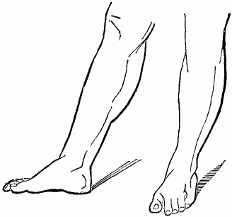 Seventh attitude of the legs