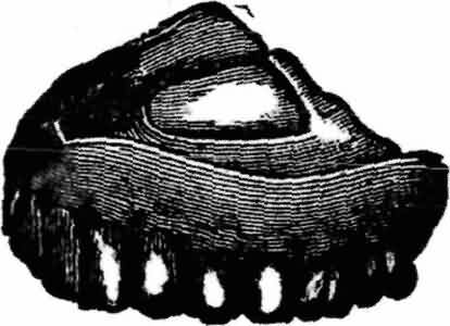 Line Drawing of Human Upper Jawbone