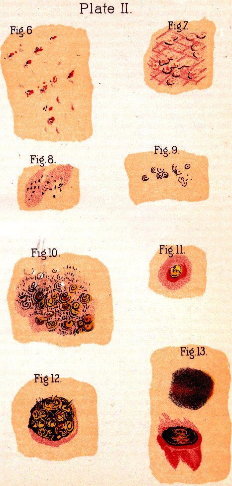 Illustration: Plate II. Fig. 6. Fig. 7. Fig. 8. Fig. 9. Fig. 10. Fig. 11. Fig. 12. Fig. 13.