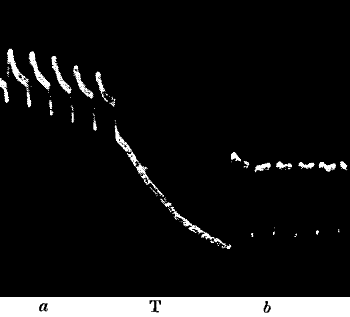 Fig. 79.—The Normal Response a in Nerve Enhanced to b after Continuous Stimulation T (Waller)