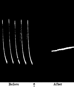 Fig. 92.—Abolition of Response by Oxalic Acid