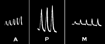 Fig. 114.—‘Staircase’ in Muscle, Plant, and Metal