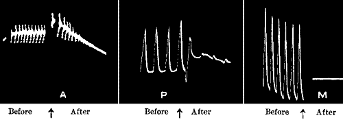 Fig. 117.—Abolition of Response in Nerve, Plant, and Metal by the Action of the same ‘Poison’