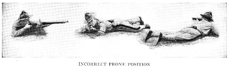 INCORRECT PRONE POSITION