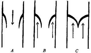 DIAGRAM OF VALVES IN THE VEINS AND HEART