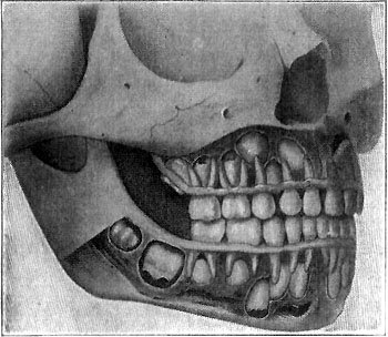 THE REPLACING OF THE MILK TEETH