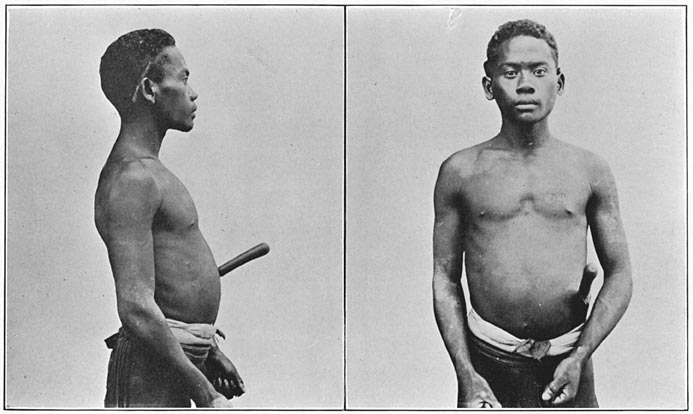 Negrito man of Zambales (pure blood).