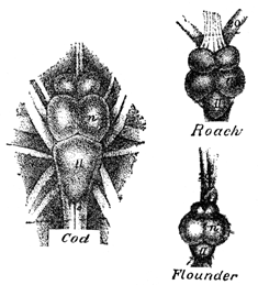 Three brains described next in text.