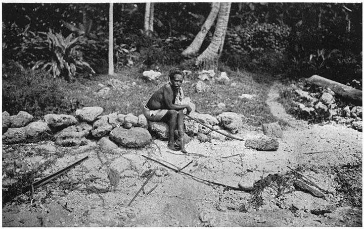 WOMAN ON NITENDI, WITH LARGE SORE ON FOOT.