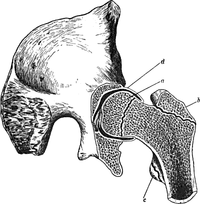 Fig. 60.—Section through Hip-Joint to show epiphyses at upper end of femur, and their relation to the joint.