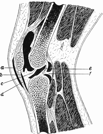 Fig. 80.—Section of Knee-joint showing extent of Synovial Cavity.