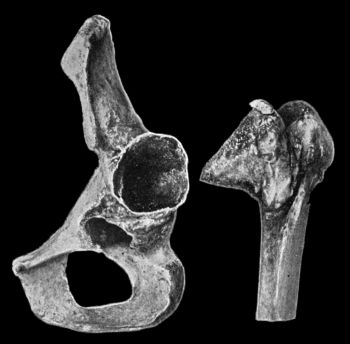 Fig. 129.—Innominate Bone and upper end of Femur from a case of Congenital Dislocation of Hip.