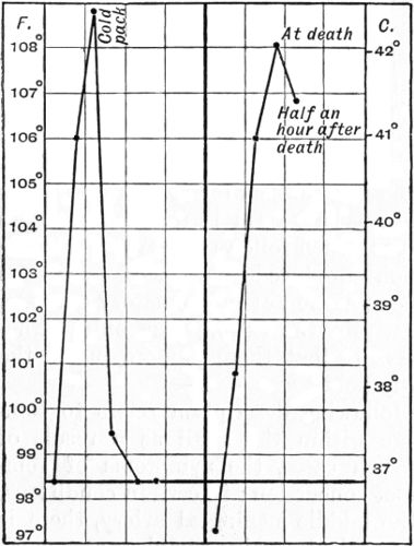 Fig. 185.—Two Charts of Pyrexia in Head Injuries.