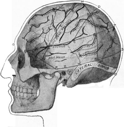 Fig. 186.—Relations of the Middle Meningeal Artery and Lateral Sinus to the surface as indicated by Chiene's Lines.