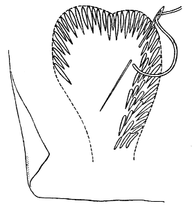 Fig. 4.—Feather or Crewel Stitch—a mixture of long and short stitches.