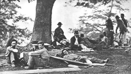 Amputees, like these Union soldiers who survived the surgeon's scalpel, would never forget the traumatic ordeal. Most wounded went through surgery while fully conscious with but a little morphine, when available, to deaden the pain.