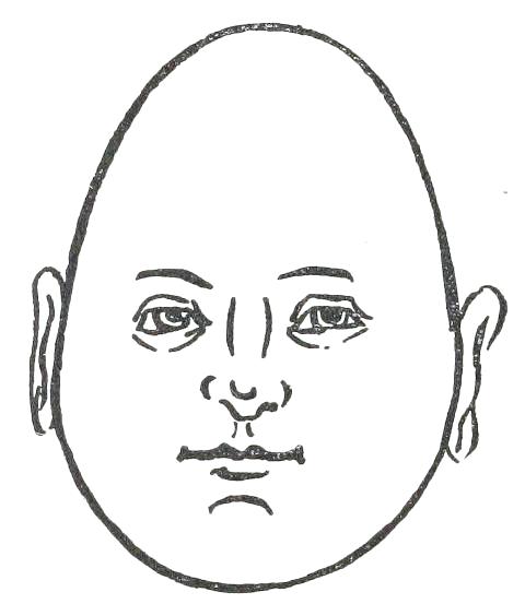 Fig. 17  INVERTED EGG-SHAPED FACE