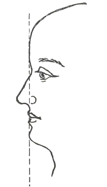 Fig. 20  CHIN STUDY