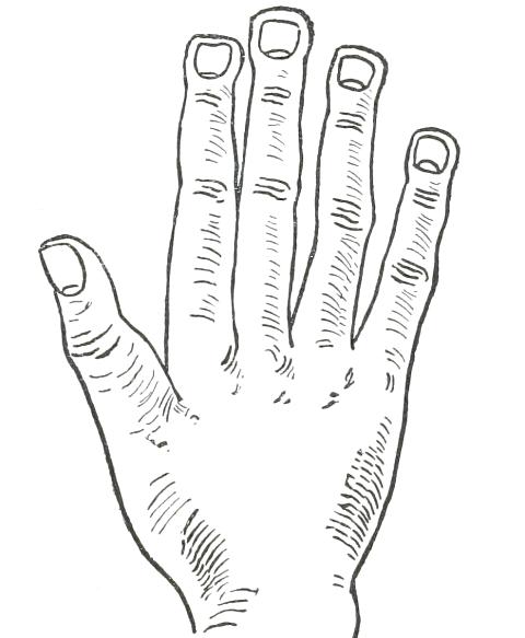 Fig. 23  SPATULATE HAND