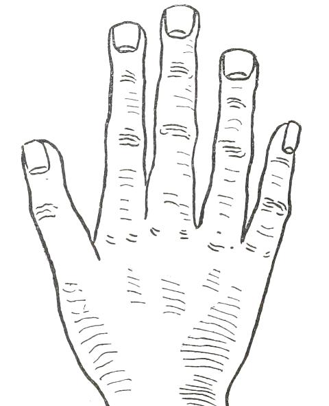 Fig. 24  SQUARE HAND