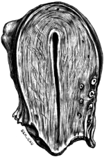 A Uterus in Sagittal Section