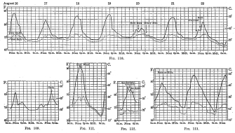 Figs. 109-113—Temperature curves for locations in the montaña, July and August, 1911. The curves are based on hourly readings with interpolated readings for such critical occurrences as the appearance of cloud or rain. Dry bulb readings are shown by solid lines, wet bulb by dotted lines, and breaks in the continuity of the observations by heavy broken lines. Fig. 109 is for Pongo de Mainique, August 20 and 21; Fig. 110 for Yavero; Fig. 111 for Santo Anato, August 11 and 12; Fig. 112 for Sahuayaco, August 20, and Fig. 113 for Santa Ana, July 30 to August 1.