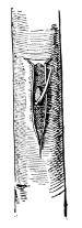 Fig. 269. The bud set in the matrix. One-half natural size.