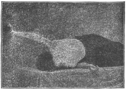 Exercise No. 1.—Reclining on right side and raising left arm, with dumb-bell in hand and elbow rigid from hips to high over head. Same exercise with right arm while reclining on left side. Inhale deep breath as arm goes back.