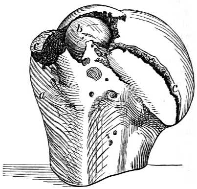 Head of humerus.