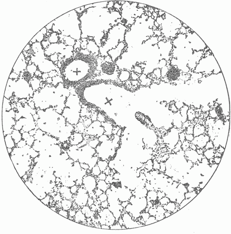 Fig. 6—Photograph Of A Section Of The Lung Of A Mouse. x x are the air tubes or bronchi which communicate with all of the small spaces. On the walls of the partitions there is a close network of blood vessels which are separated from the air in the spaces by a thin membrane.