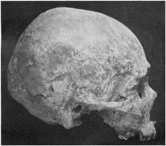 Plate 8b: Profile