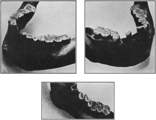 Plate 18a-c