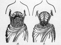 Nature Versus Corsets Illustrated.