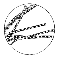 Threads of Bacillus
Anthracis, Showing Spores