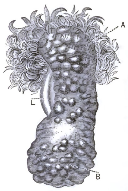 Pachydermatous tumor