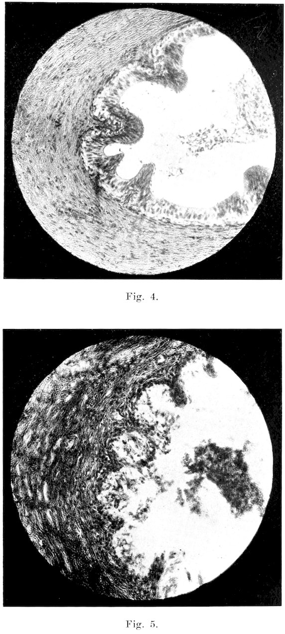 Fig. 4. Fig. 5.