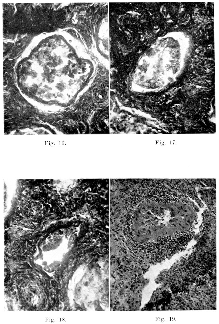 Fig. 16. Fig. 17. Fig. 18. Fig. 19.