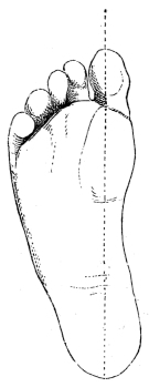 Normal alignment of toes